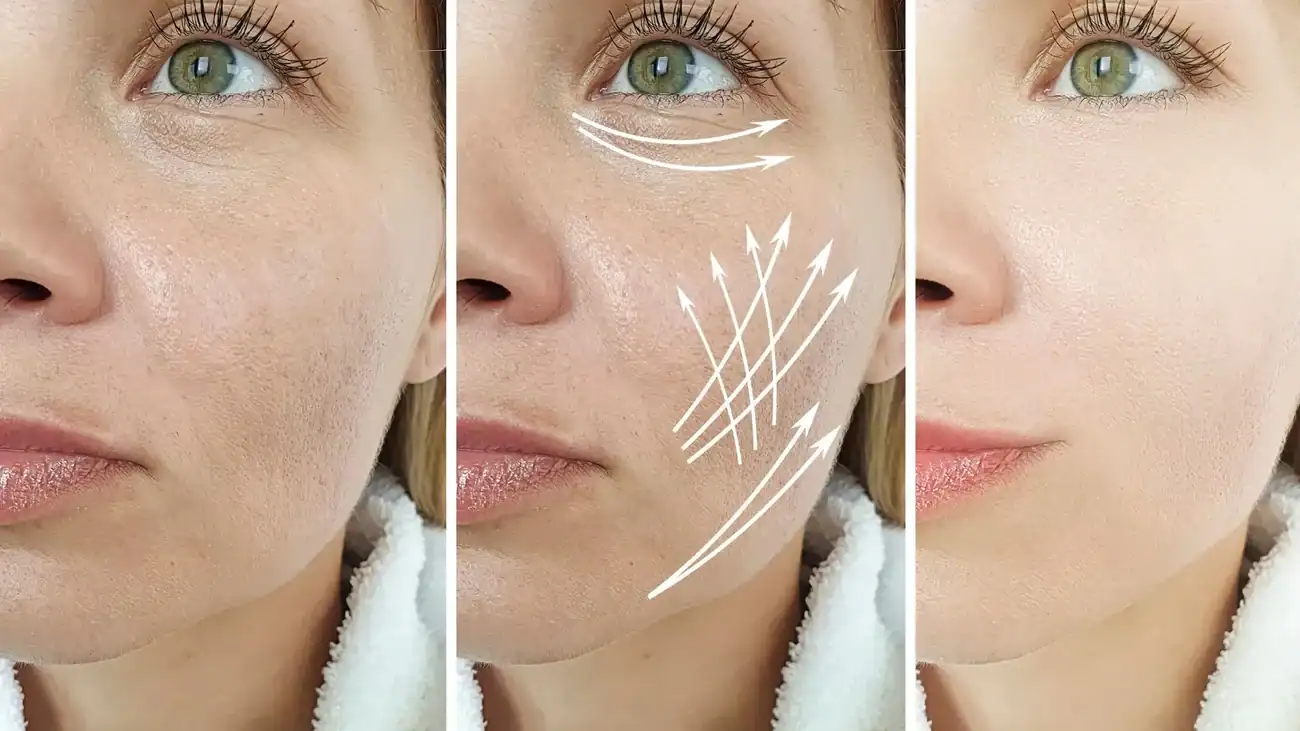 Can One Treatment Really Tackle More Than One Skin Concern Luton?